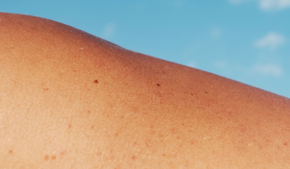 How to Get More Vitamin D (Besides Sunlight)